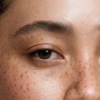FOREHEAD PATCHES