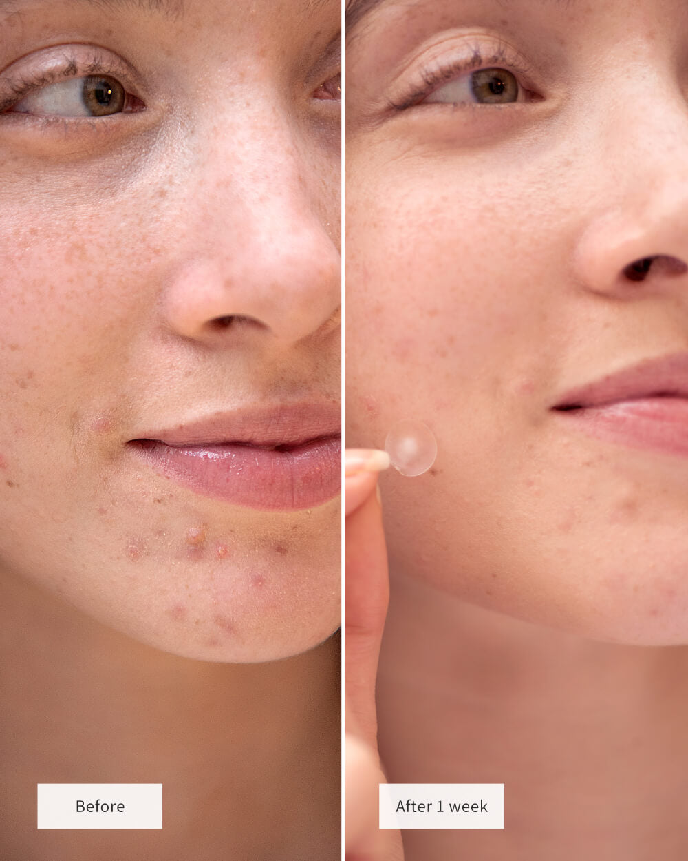 CLEARING SPOT PATCHES – Vue Swiss