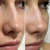 DUO PORES NETS