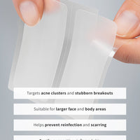SURFACE PATCHES
