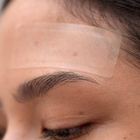 SURFACE PATCHES