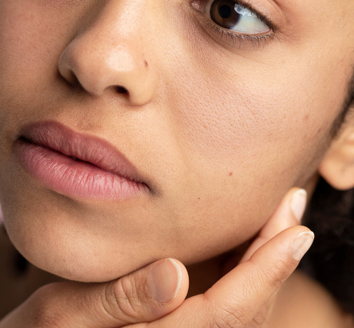 Understanding Sebaceous Filaments: What They Are and How to Manage Them