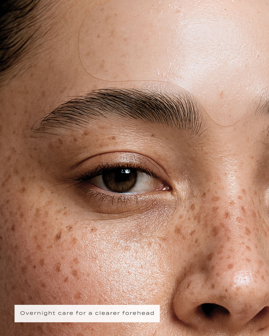 FOREHEAD PATCHES