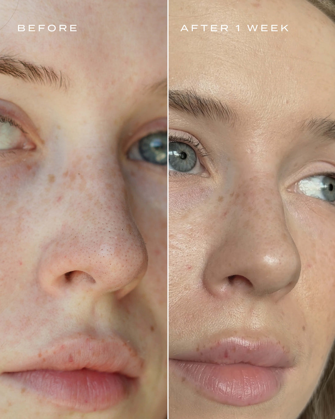 PORE PERFECTION KIT